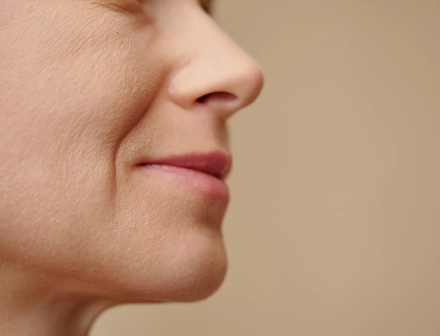 Comment atténuer les sillons nasogéniens ? Essayez la combinaison acide hyaluronique + fils tenseurs