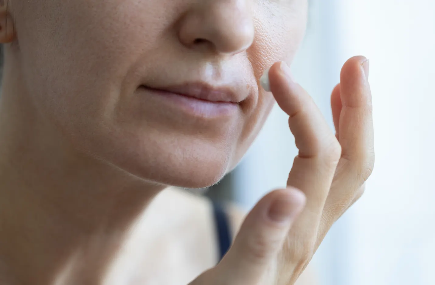 Comment atténuer les sillons nasogéniens ? Essayez la combinaison acide hyaluronique + fils tenseurs