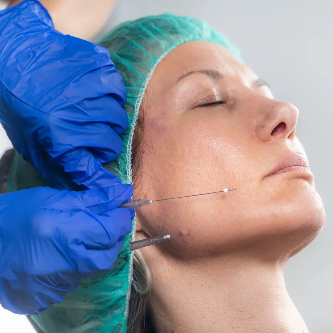 Fils tenseurs utilisés sur une femme