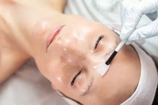 Peelings superficiels : Tout ce que vous devez savoir